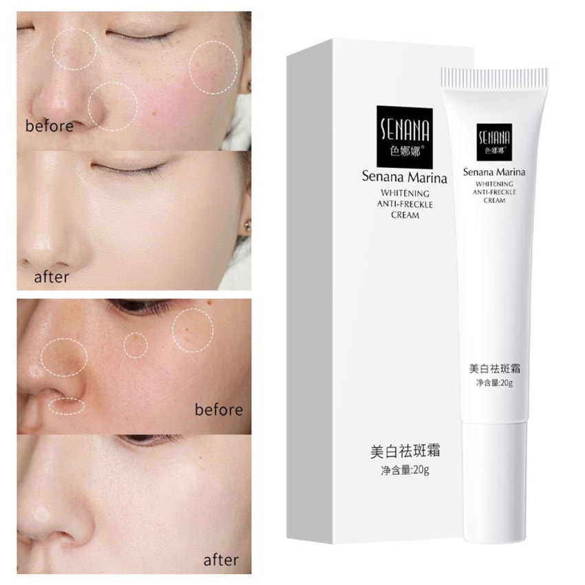 Kem Hỗ trợ giảm tàn nhang Làm Trắng Da Dưỡng Ẩm 20g