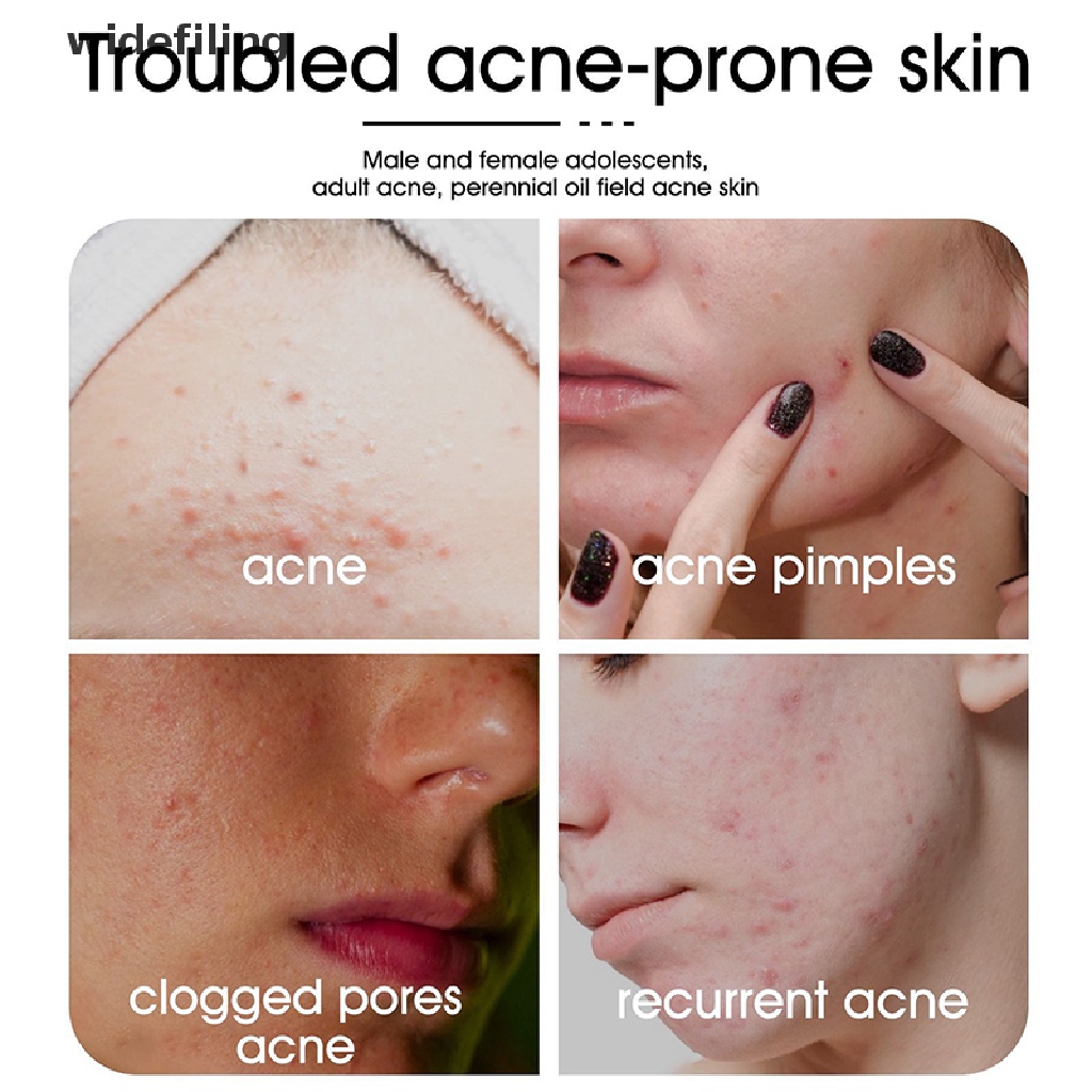 Bộ 2 Miếng Dán Kích Thước Lớn Chứa Hydrocolloid Hỗ trợ giảm mụn