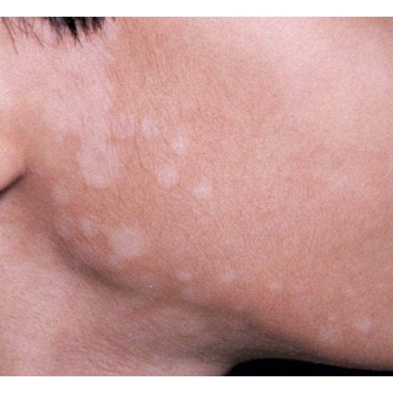 KEM BÔI LANG BEN  THÁI LAN