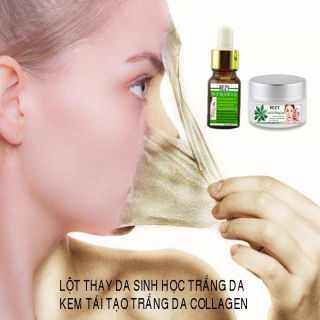 COMBO KEM LỘT TRẮNG DA NÁM
