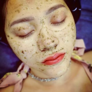 Liệu trình peel da 4 lần kèm tế bào gốc