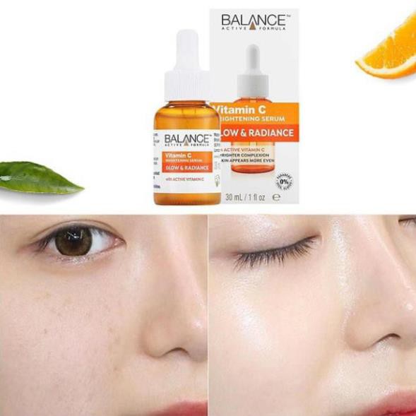 ( Mẫu Mơi )Serum Vitamin C Balance 30ml - Làm sáng da ngừa mụn