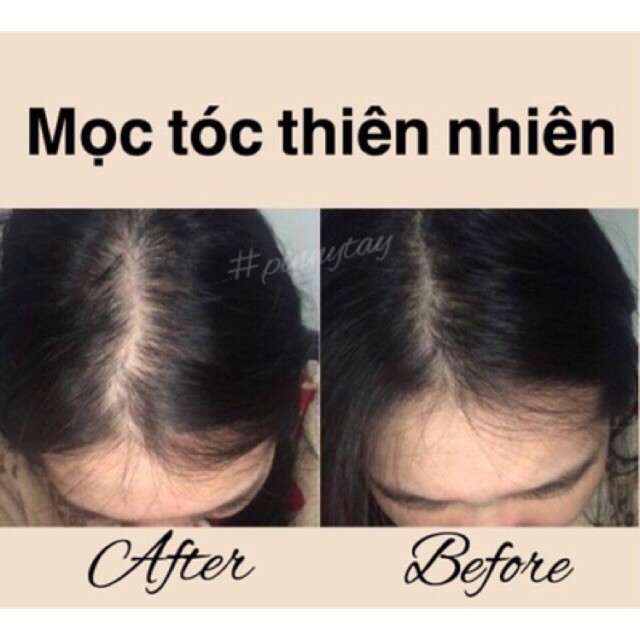 Dầu Gội Làm Sạch Và Ngăn Rụng Tóc Hiệu Quả, Làm Tóc Dày Hơn Radical Med Anti-Hair Loss Shampoo Đỏ 300ml