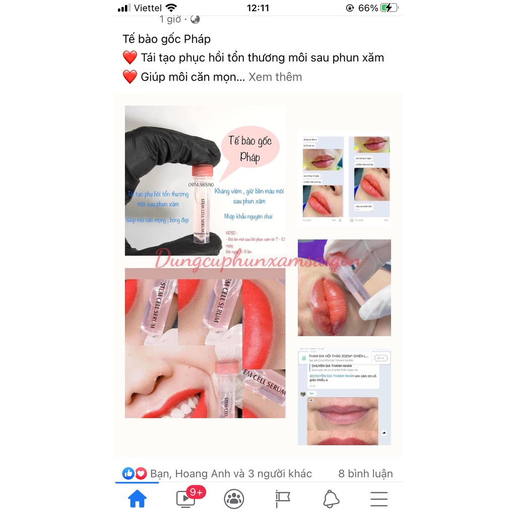 Tinh Chất Dưỡng Môi Tế Bào Gốc Pháp Serum Dưỡng Môi Stem Cell - Dungcuphunxamsaigon