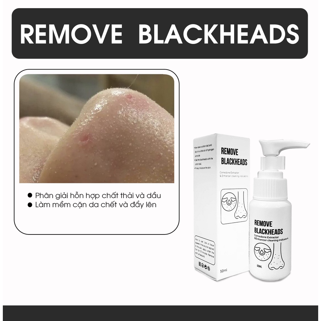 Dung dịch xử lí sợi bã nhờn và mụn đầu đen vùng mũi Remove Blackheads - Ủ mụn Remove Blackheads Lepit Cosmetic