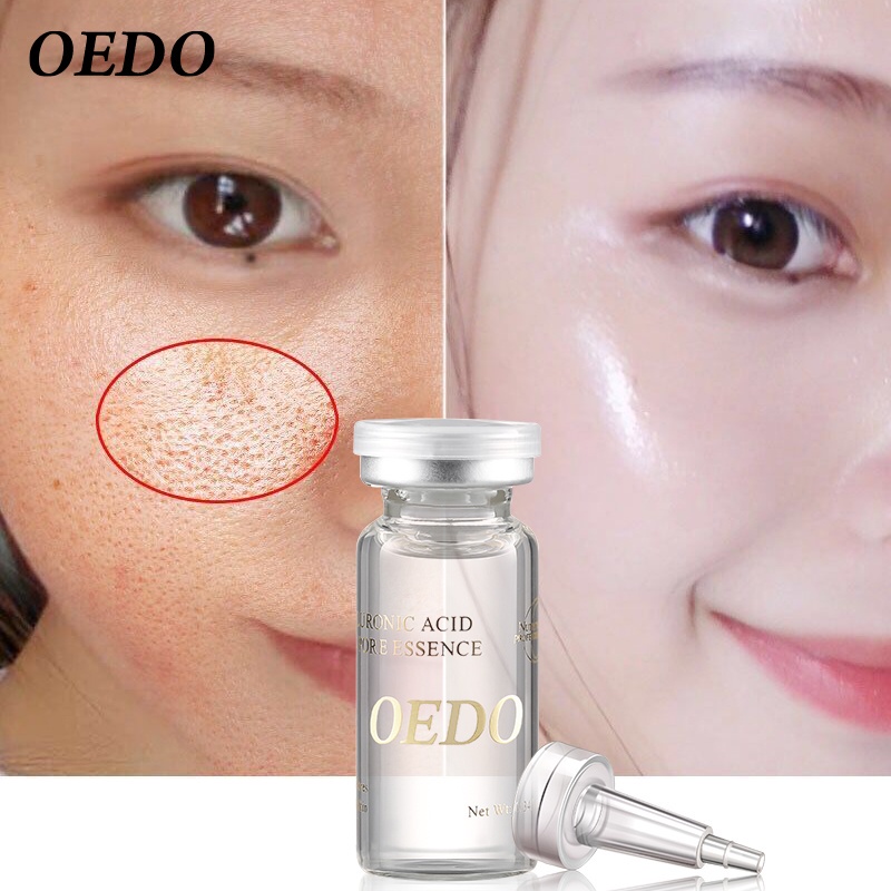 Set mỹ phẫm OEDO gồm sữa rửa mặt Amino Acid làm sạch sâu+kem dưỡng ẩm chống nếp nhăn+tinh chất thu nhỏ lỗ chân lông