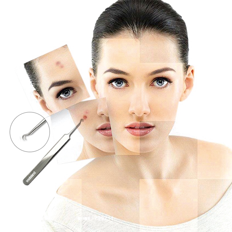 Bộ 3 nhíp loại bỏ mụn đầu đen dụng cụ chăm sóc da mặt Brainbow