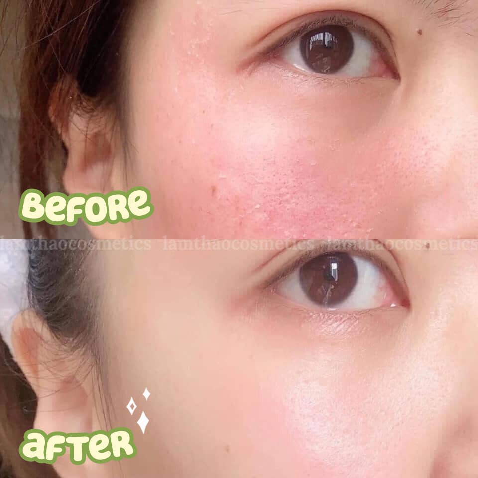 Kem Dưỡng Phục Hồi Da Avene Cicalfate+ Repairing Protective Cream