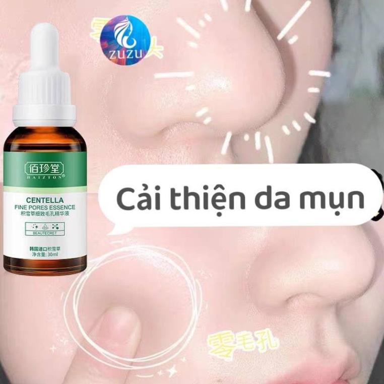 Tinh Chất Rau Má Giảm Mụn, Dịu Da đồng thời dưỡng ẩm hạn chế da tiết dầu, khiến da mềm mại săn chắc zuzu cosmetic