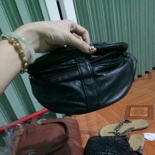 Túi bao tử