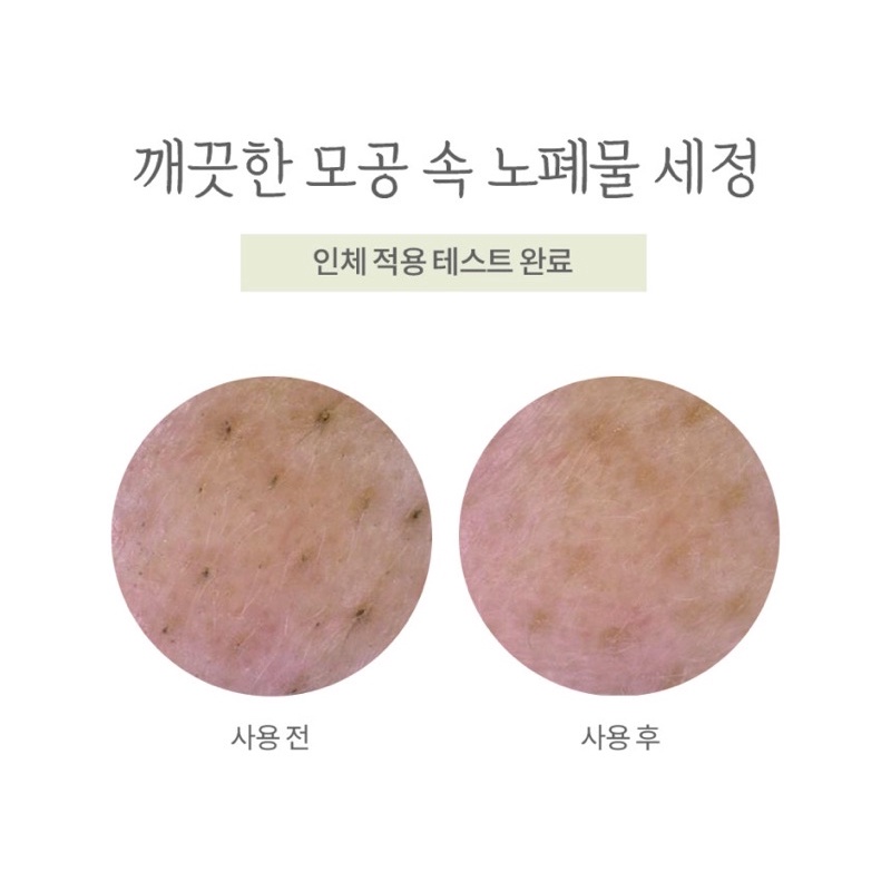 Sữa rửa mặt sạch sâu cho da dầu mụn Manyo Purifying Soda Foam