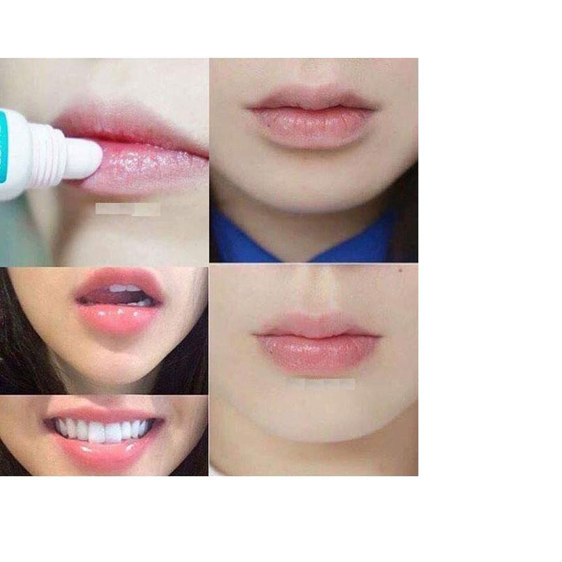 Combo Gel Dưỡng Da Môi, Cải Thiện Thâm Sạm, Bong Tróc Môi Mediheal Labocare Panteno Lips ( Đỏ + Xanh )