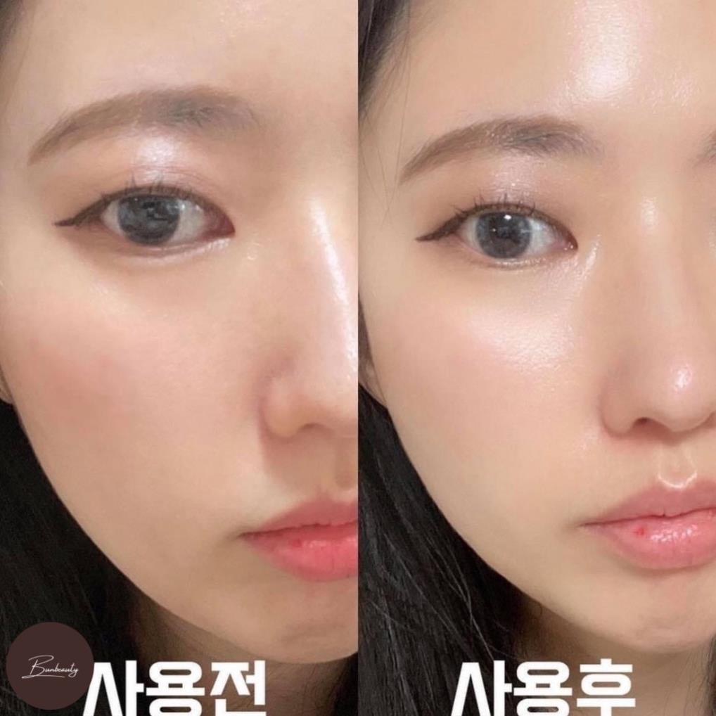 Xịt Khoáng Làm Trắng Chống Lão Hóa Ildong Probiotic Moist Mist 100ml Xịt khoáng dưỡng ẩm make up Hàn Quốc | BigBuy360 - bigbuy360.vn