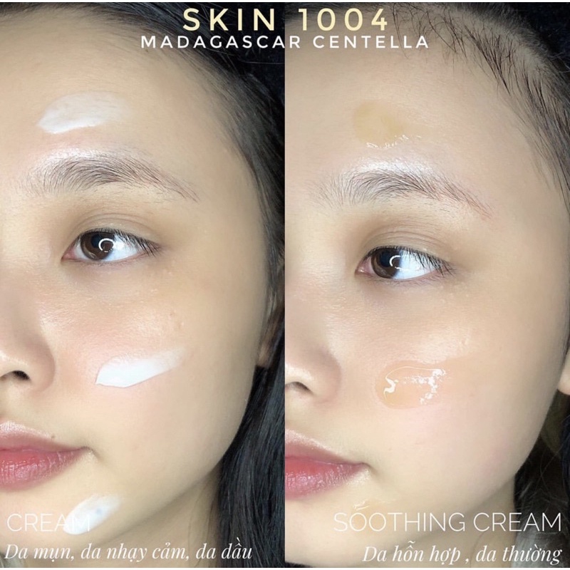 Kem dưỡng ẩm phục hồi da Skin1004 Madagascar Centella