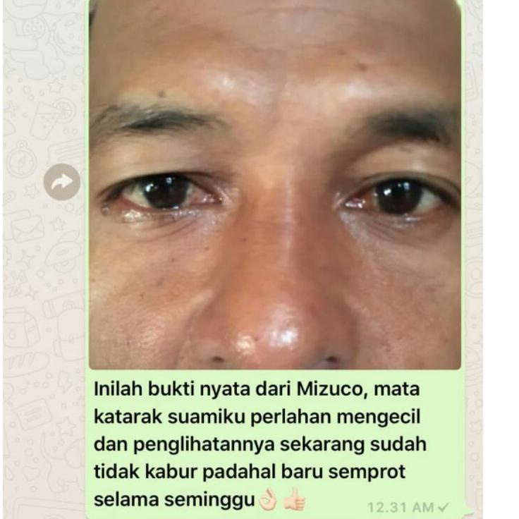 ⭐ Xịt Cố Định Mizuco (Bộ 139) (trims,.) | BigBuy360 - bigbuy360.vn