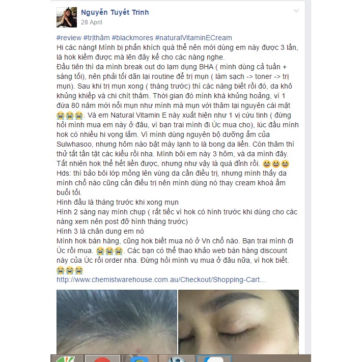 [MẪU MỚI] Blackmores Vitamin E Cream kem dưỡng da 50g | BigBuy360 - bigbuy360.vn