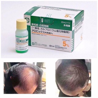 TINH CHẤT KÍCH THÍCH MỌC TÓC NHẬT BẢN - SATO AROVICS 5%