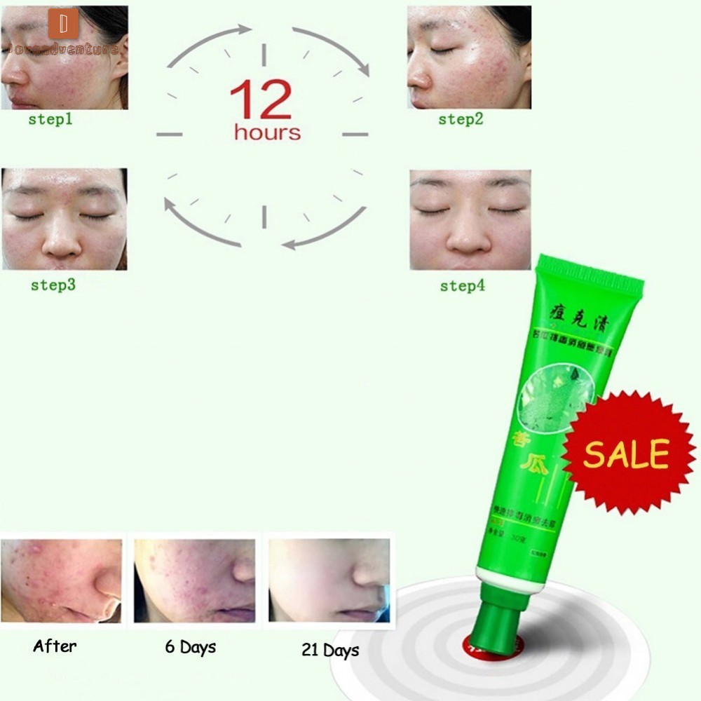 Kem Hỗ Trợ Giảm mụn / sẹo và kiềm dầu 30g nhãn hiệu DOCACNE | BigBuy360 - bigbuy360.vn