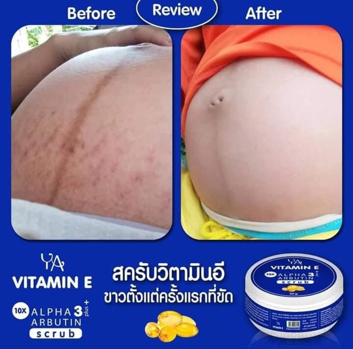 Tẩɏ tế bào chết Ya vıtamın E Alpha Arbutin 3 Plus Scrub Thái Lan