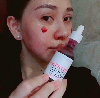 PEEL DA KHÔNG BONG TRÓC