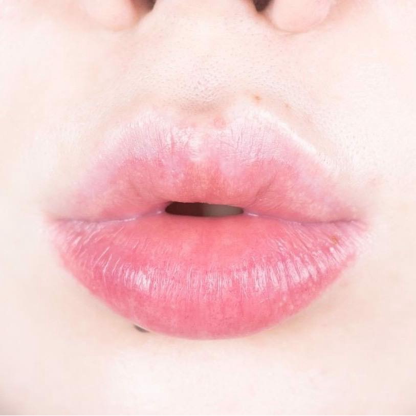 Mặt nạ môi Dearmay Vita Hydrogel Lip Patch