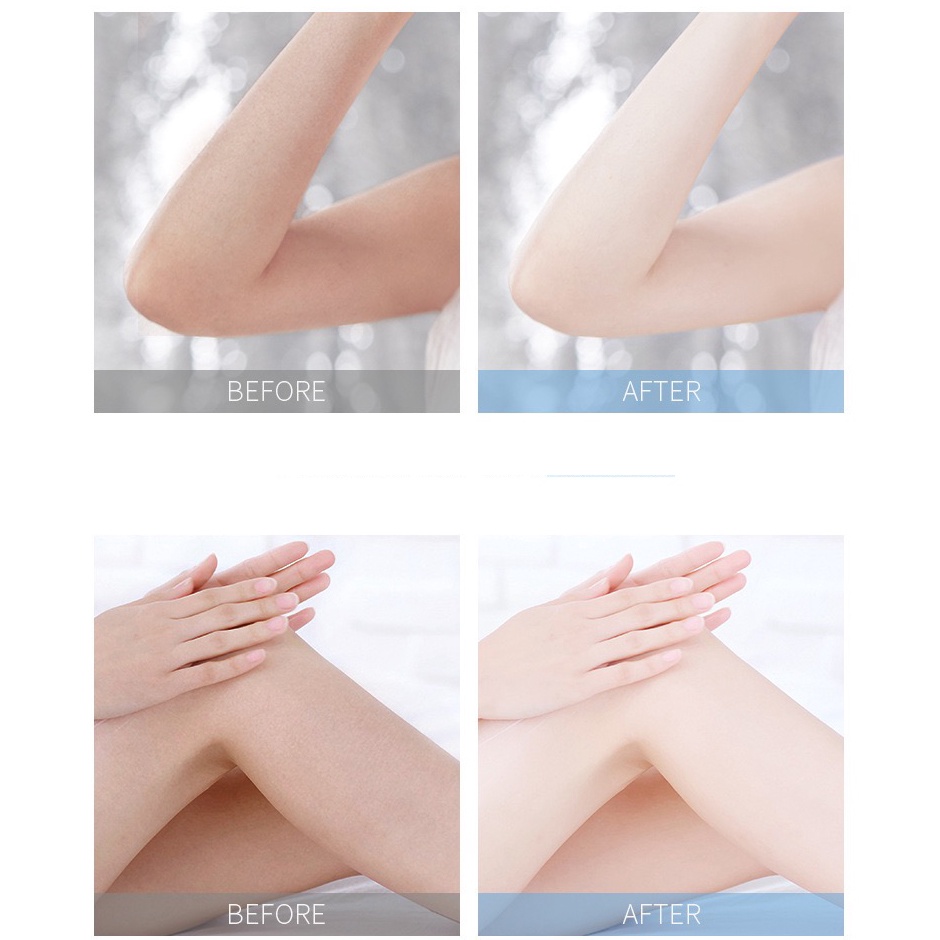 Kem Tẩy Tế Bào Chết Fenyi Làm Sạch Sâu Cho Cơ Thể