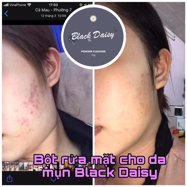 Bột rữa mặt Black Daisy-64 loại thảo mộc thiên nhiên+kèm xẻng và bọt biển rữa mặt