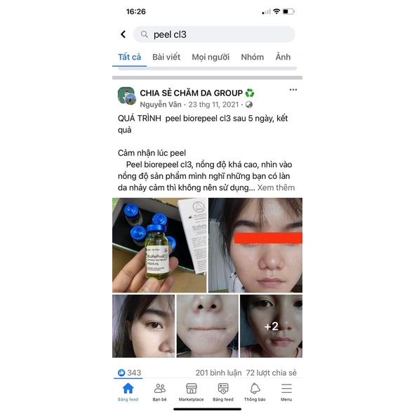 Peel da Bio-repeelcl3 da căng bóng