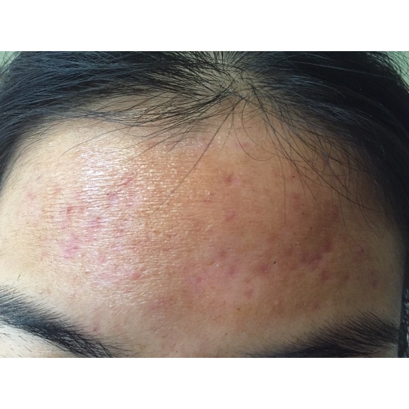 Bộ kem tái tạo da 210