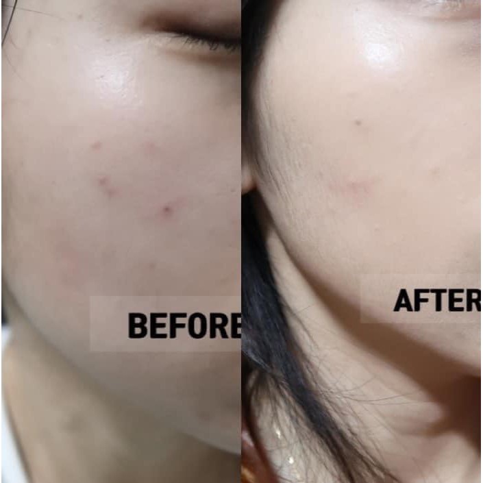 Kem Chấm Mụn Cellmula Ac Clear Spot | BigBuy360 - bigbuy360.vn