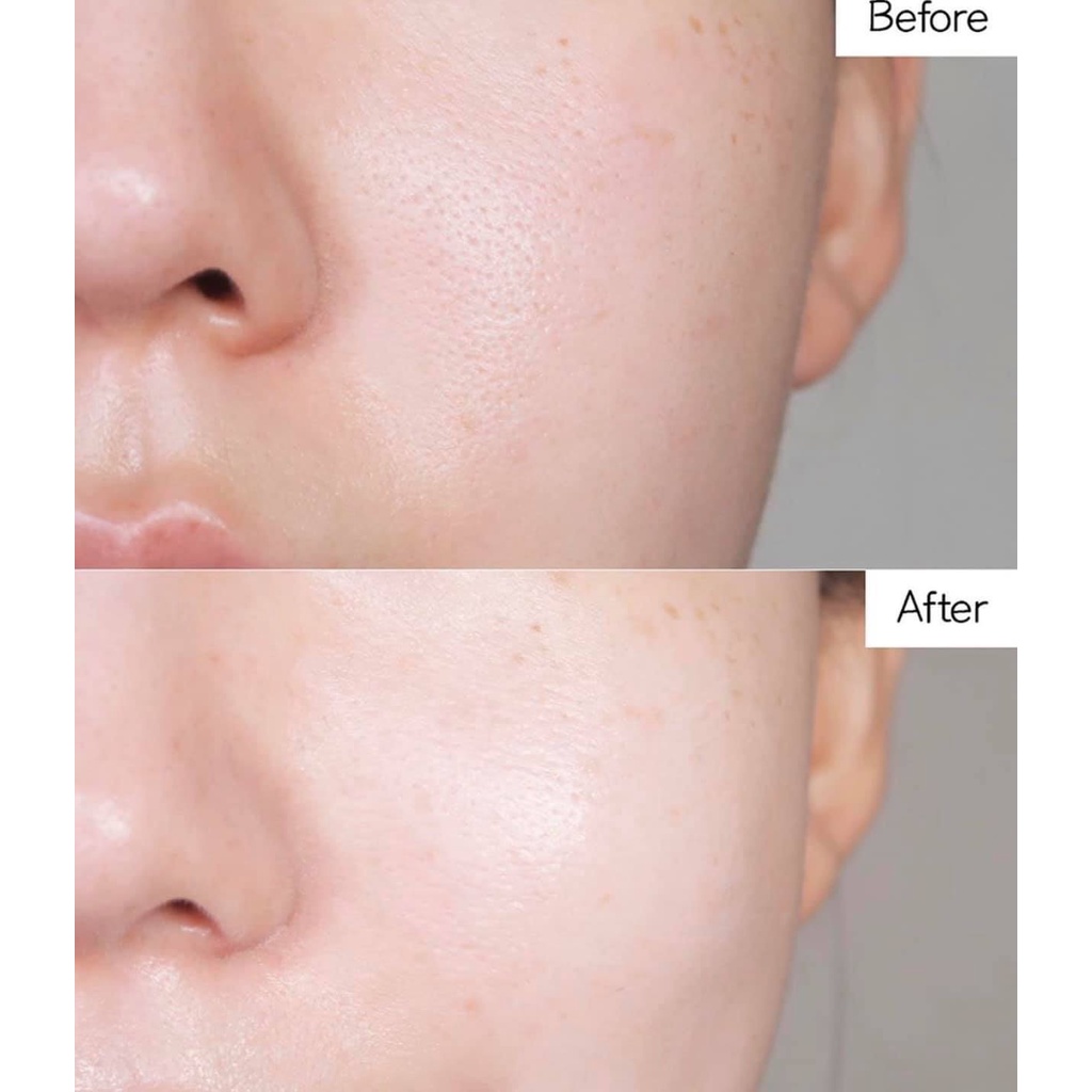 Kem dưỡng La Roche Posay Cicaplast Baume B5 làm dịu và phục hồi da kích ứng mẩn đỏ