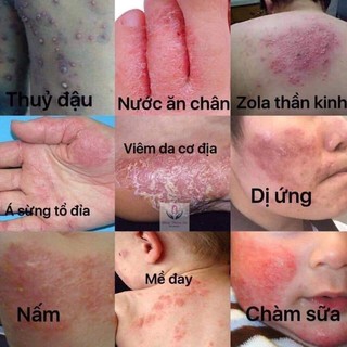 kem mul rose mới nhất