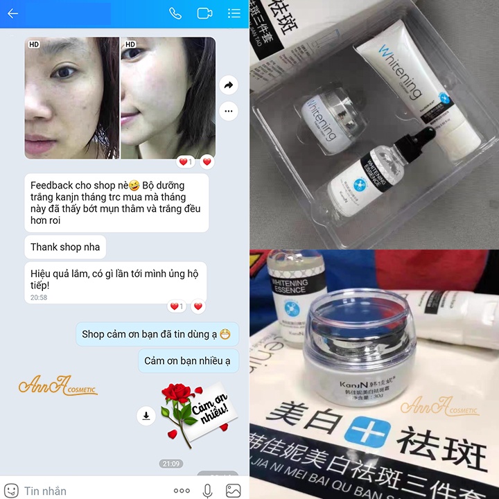 Bộ chăm sóc da skincare dưỡng trắng da Whitening KanjN, bộ mỹ phẩm nội địa trung Ngăn Ngừa Nếp Nhăn Set 3 Món