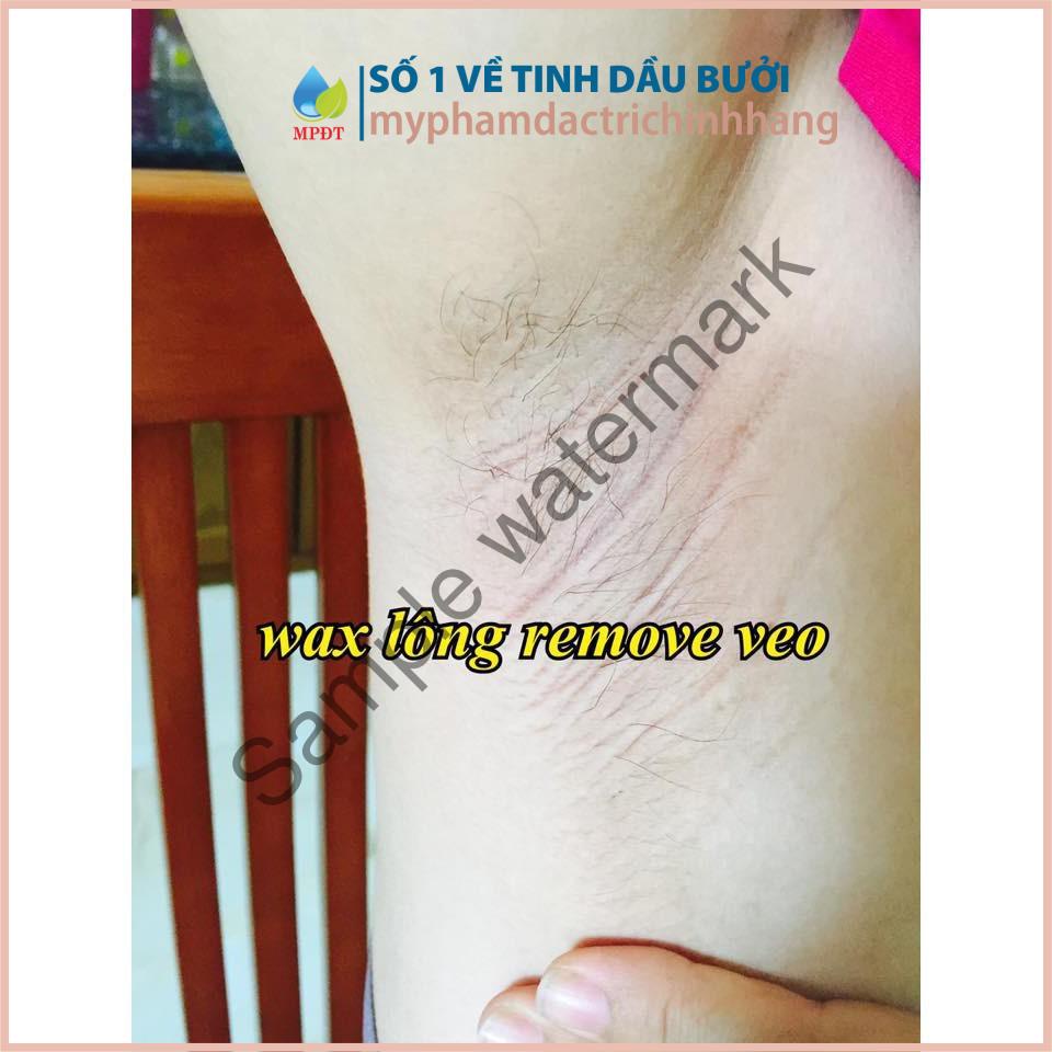 Wax VEO triệt lông vùng nách, lông tay, chân,... an toàn, nhanh chóng, da trắng láng mịn