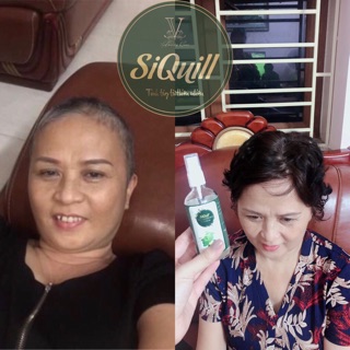 TINH DẦU BƯỞI NON SIQUILL