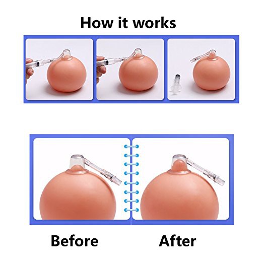 Chữa đầu ti thụt, ngắn,lõm Nipple  Corrector hiệu quả vĩnh viễn