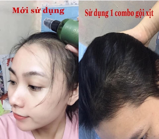 [TẶNG CỘT TÓC] Tinh Dầu Bưởi Kích Mọc Tóc Nhanh- Giảm Rụng Tóc- Làm Dài và Dày Tóc- Nuôi Dưỡng Chân Tóc Chắc Khoẻ | BigBuy360 - bigbuy360.vn