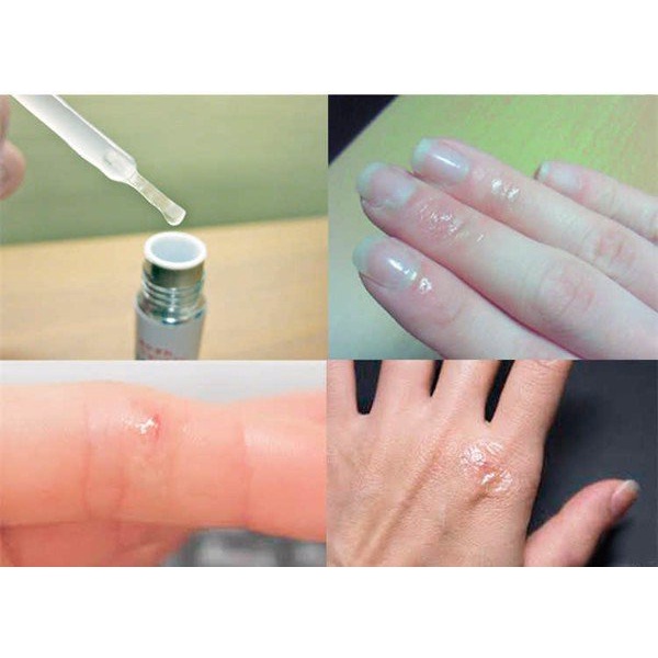 Gel bôi vết thương hở, đứt tay, vết xước Nhật Bản Kobayashi 10g giúp liền vết thương, bảo vệ vết thương hở