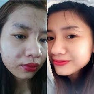 thuốt bắc tái tạo da 50ml
