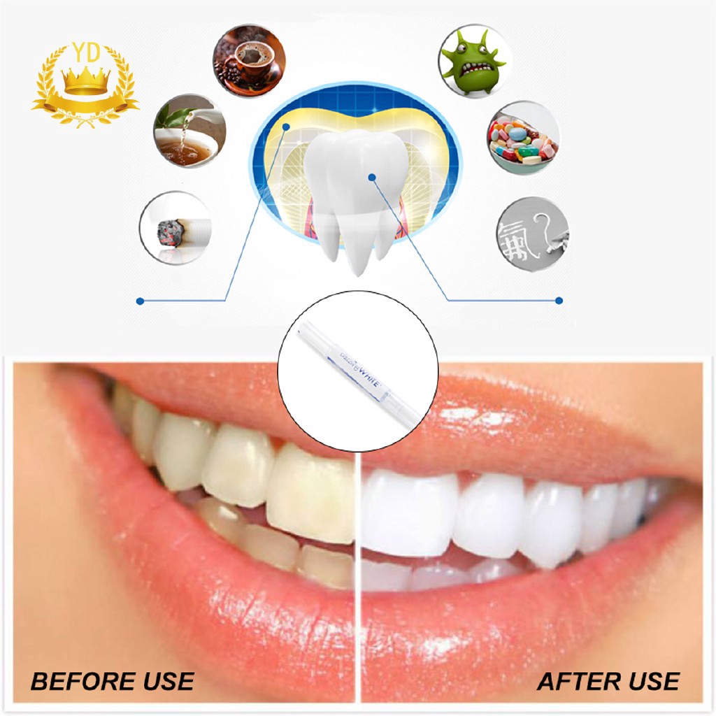 Bút làm trắng răng dạng xoay cao cấp tiện dụng
