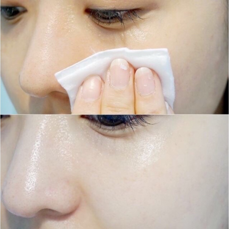 Toner RiRe thu nhỏ l.ỗ chân lô.ng