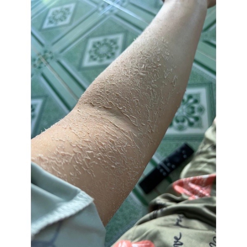 Kem Body Bong Tái Tạo Da Handmade Kim Spa Cao Cấp Không Hoá Chất