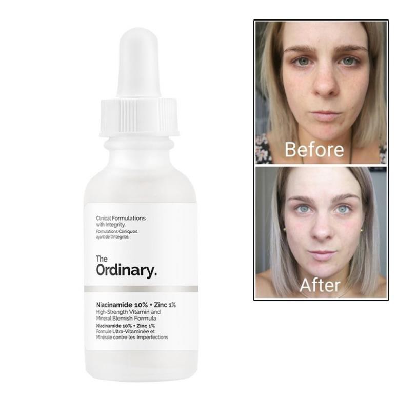 The Ordinary - Tinh chất giảm mụn thâm The Ordinary Niacinamide 10% + Zinc 1% - 30ml - Bebeau [Chính Hãng]