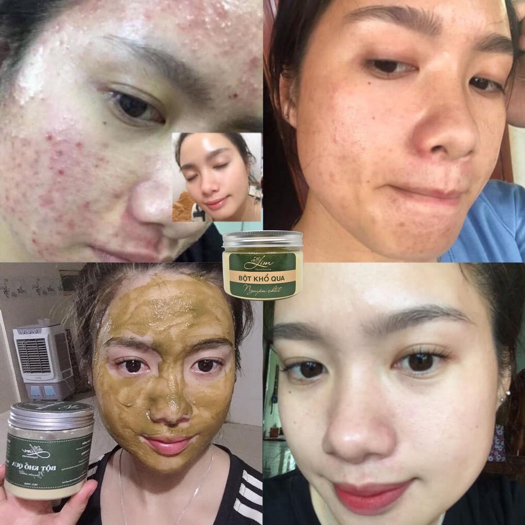 [MASK LIM]-Khổ Qua Rừng 100g Giảm Mụn , Mờ Thâm , Dưỡng Da Căng Bóng , Chống Lão Hóa , Bột Khổ Qua Rừng - Handmade