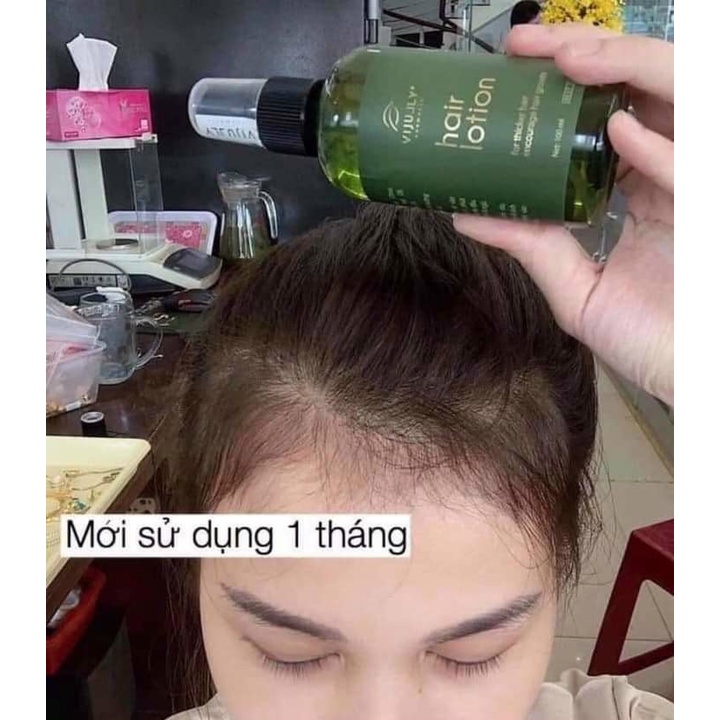 Tinh Dầu Dưởi Dưỡng Tóc ViJully, Giảm Rụng Tóc, Làm Dài Tóc Phục Hồi Hư Tổn, Dung Tích 100ml