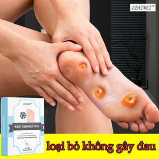 Bác sĩ khuyên dùng！ Elaimei Miếng dán mụn cóc,24 miếng/Hộp Lột không đau,không mọc lại (Miếng dán plasters Mụn cóc,Mụ