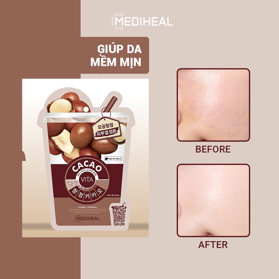 [Nhập mã COSMH22 giảm 8%]Mặt Nạ Ca Cao Giúp Làm Mịn Da Mediheal Cacao Vita Mask 20ml [K11]