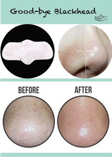 [Auth] Mặt nạ đẩy mụn đầu đen Good-bye Blackhead