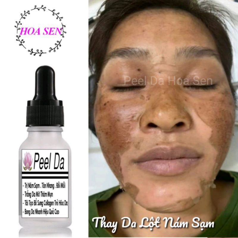 PEEL LỘT THAY DA HOA SEN