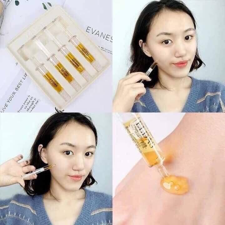 Serum tế bào gốc Eldas EG Tox Program Coreana mini 4 ống